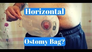 Wearing Your Ostomy Bag Horizontally FAQ [upl. by Edmonds]