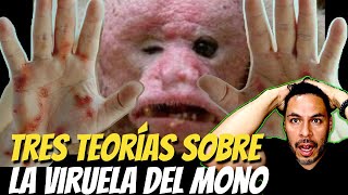 OMS declara Alerta Internacional por VIRUELA DEL MONO  ¿Qué PASA EN VERDAD [upl. by Uile30]