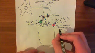 Strokes and Excitotoxicity Part 2 [upl. by Towbin]