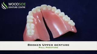 Denture Repair in Airdrie AB  Woodside Denture Centre [upl. by Norman600]