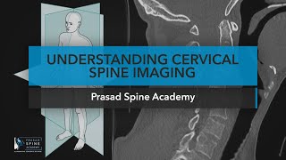 Understanding Cervical Spine Imaging Chapter 2 FULL [upl. by Evered243]