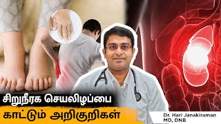 Kidney Failure Symptoms in Tamil  Warning Signs and Symptoms of Kidney Disease Salem Gopi Hospital [upl. by Ledarf]