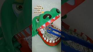 Crocodile Dentist Biting Challenge shorts asmr crocodilegaming trending funnyvideo funtoys [upl. by Branen]