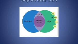 Sepsis pathophysiologySIRS and CARS [upl. by Aisyram]