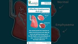 What is a emphysemaemphysemaempyemapneumothoraxhydrothoraxhemothoraxpyothorax [upl. by Wolbrom]