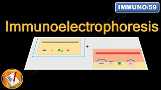 Immunoelectrophoresis FLImmuno59 [upl. by Navak]