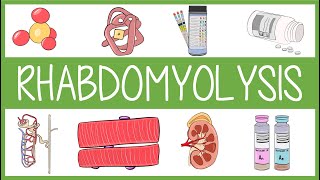 Rhabdomyolysis [upl. by Allesor377]