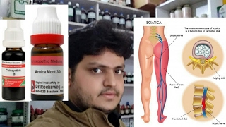 homeopathic medicine for treatment of sciatica explain [upl. by Ennovihs]