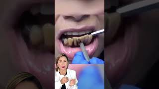 Si no se elimina a tiempo puede causar problemas como caries y enfermedades periodontales [upl. by Dlanar961]