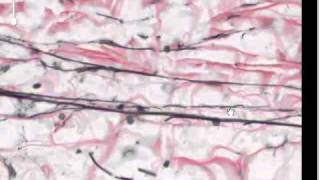 Connective Tissue Part 4  Elastic and reticular fibres [upl. by Madonia]