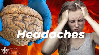 What is Causing Your Headaches [upl. by Annaeel]