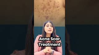 acne scar treatment  how to get rid of acne scars  silicon creams  retinoids  silicon for scars [upl. by Nirahs]