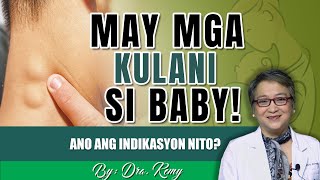 MAY MGA KULANI SI BABY [upl. by Divadnhoj]