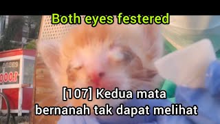 107 Kedua mata bernanah  both eyes festered [upl. by Anola]