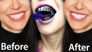 Fastest Way To Whiten Teeth At Home What REALLY Works [upl. by Demetra]