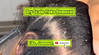 Dry scalp Flake removal [upl. by Hopper236]