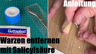 Warzen entfernen mit Salicylsäure Guttaplast Warzen Pflaster Schwielen Hühneraugen Anleitung [upl. by Nuriel]