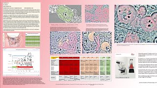 Periodontitis history of a dysbiosis and Cure Slides [upl. by Senalda]