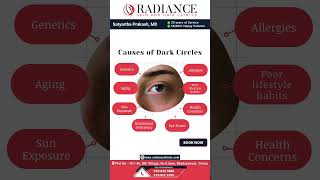 Causes of Dark Circles [upl. by Derwon]