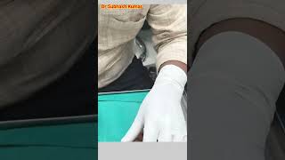 How Lignocaine Is Given Xylocaine कैसे दिया जाता है drsubhashkumar anaesthesia [upl. by Huskamp178]