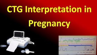 Interpretation of Cardiotocography for Assessment of Fetal Wellbeing NICE Guideline [upl. by Ikim]