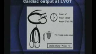 Basics Of Echocardiography Part2series2 [upl. by Voorhis551]