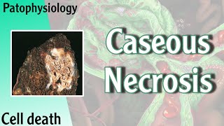 Pathophysiology  Caseous Necrosis Hani Laith شرح [upl. by Ahsotan620]