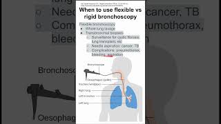 When to use flexible vs rigid bronchoscopy [upl. by Adoh647]