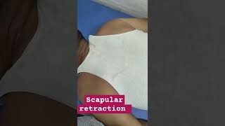 Scapular retraction [upl. by Chapnick]