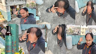 dont use avimee herbal keshpallav hair oil  results Yes or no  honest review [upl. by Solomon]