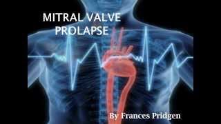 MITRAL VALVE PROLAPSE presentation [upl. by Aniez923]