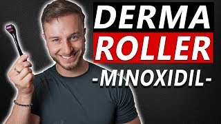 How To Use Derma Roller and Minoxidil to Regrow Hair [upl. by Micro]