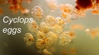 Copepod eggs [upl. by Edaw]