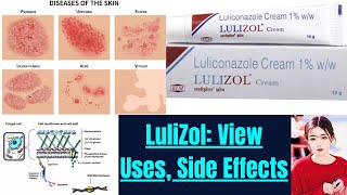 lulizole Cream Ultimate Anti fungal Solution and uses side working properties thepharmacistdrx [upl. by Sieracki]