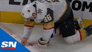 Paul Stastny Picks His Teeth Up Off The Ice After Taking Puck To Mouth [upl. by Eanel]