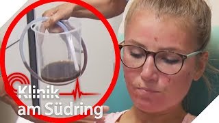 Gegen Pickel Mädchen gießt sich Kaffee ins Poloch  Klinik am Südring  SAT1 TV [upl. by Pinzler985]