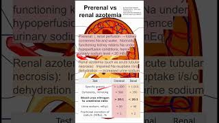 Prerenal vs renal azotemia [upl. by Atiken]