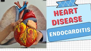 Endocarditis Disorders Types Symptoms Causes and Treatments Explained [upl. by Erv951]