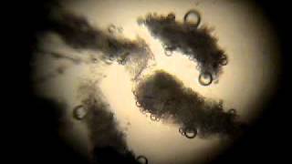 Morgellons Parasite Nano Bug Insect Peroxide Treatment and Cleansing Suggestions [upl. by Nohsar371]