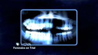 Forensics on Trial  NOVA [upl. by Anthe858]