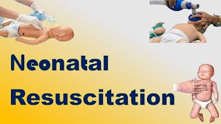 Neonatal Resuscitation  TOACS amp OSCE Station [upl. by Afira]