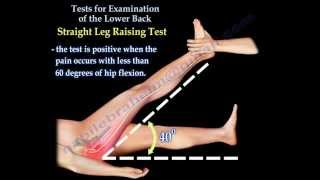 Tests For Examination Of The Lower Back  Everything You Need To Know  Dr Nabil Ebraheim [upl. by Adnalohs]