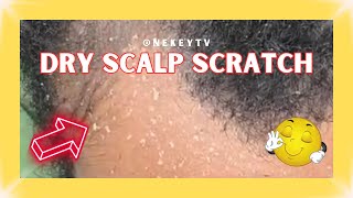 Dry Scalp Inspection 🧐 asmr naturalhair subscribe satisfying [upl. by Midas507]