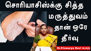 Psoriasis siddha treatment in tamil  DrPIswarya Devi MDSiddha [upl. by Atinaw]