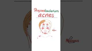 Propionibacterium acnes  Acne Vulgaris  Microbiology science microbiology nurse doctor mbbs [upl. by Greenman]