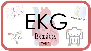 EKG Basics  Step by Step  Grundlagen Einthoven Frequenz Lagetyp PWelle QRS EKGKurs [upl. by Einafpets]