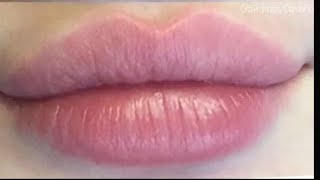 Heart shaped kisses ♡ lip filler procedure lip lift pink rosy color 💉 [upl. by Nari]