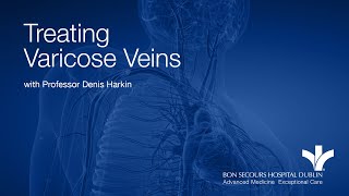 Treating Varicose Veins with Professor Denis Harkin [upl. by Atnaloj]