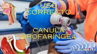 Como usar correctamente la Cánula Orofaríngea [upl. by Theobald]