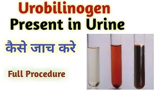 urobilinogen test procedure  urobilinogen test  urobilinogen test strips [upl. by Edahc928]